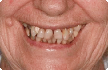 До